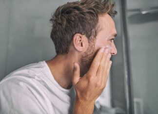 Mi hanno Diagnosticato la Dermatite Seborroica. Rimedi? la Dermatite Seborroica. Rimedi?