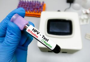 HPV TEST