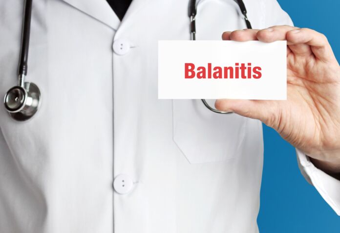 Balanitis. Doktor mit Stethoskop (isoliert) zeigt Karte. Hand hält Schild mit Text. Blauer Hintergrund. Medizin, Gesundheitswesen Balanite