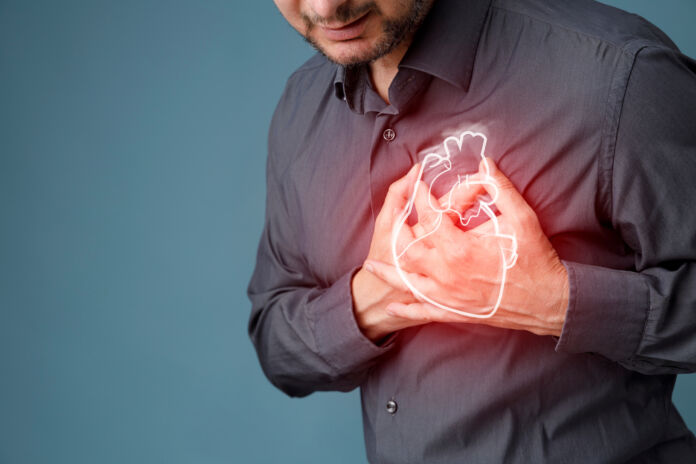 Heart attack Statine